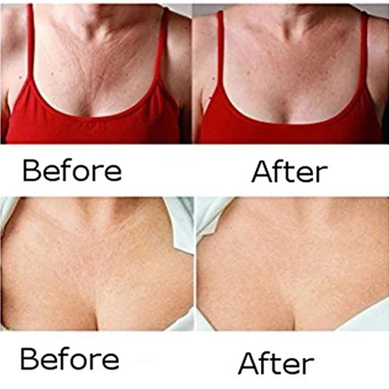 GodNatt- Parches de Silicona para Escote y Cuello – Reutilizables y Antiarrugas