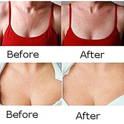 GodNatt- Parches de Silicona para Escote y Cuello – Reutilizables y Antiarrugas