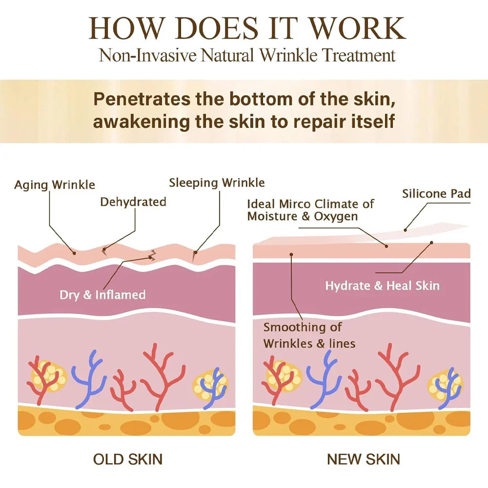 GodNatt- 16 Uds parches de silicona reutilizables contra arrugas del sueño