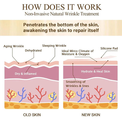 GodNatt- 16 Uds parches de silicona reutilizables contra arrugas del sueño